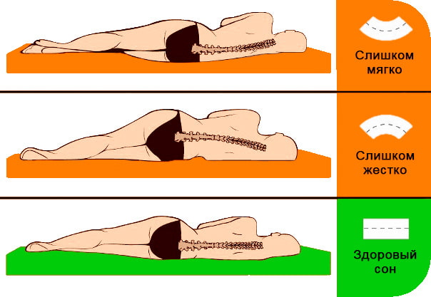 Orthopedic mattress firmness